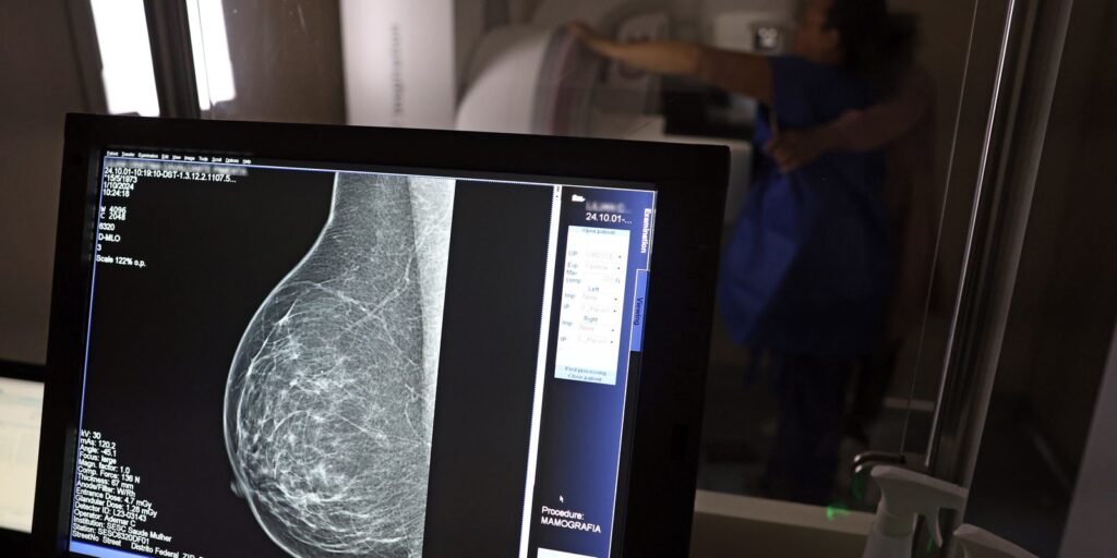 AGU processa médico que apontou mamografia como causadora de câncer